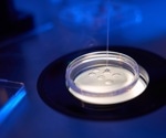Advancing cellular analysis: Unravelling cytoplasmic lattices in oocyte development