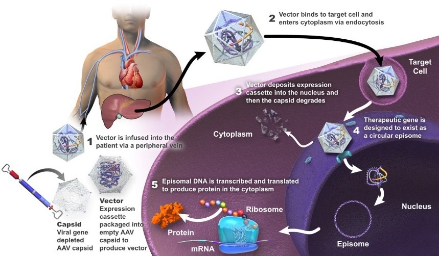 Summary of mechanism of action of gene therapy using AAV vector (adapted from https://encyclopedia.pub/entry/37119)