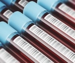 Why is complete data of human tissue biospecimens important?