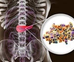 Analyzing thermal aggregation transitions in human insulin