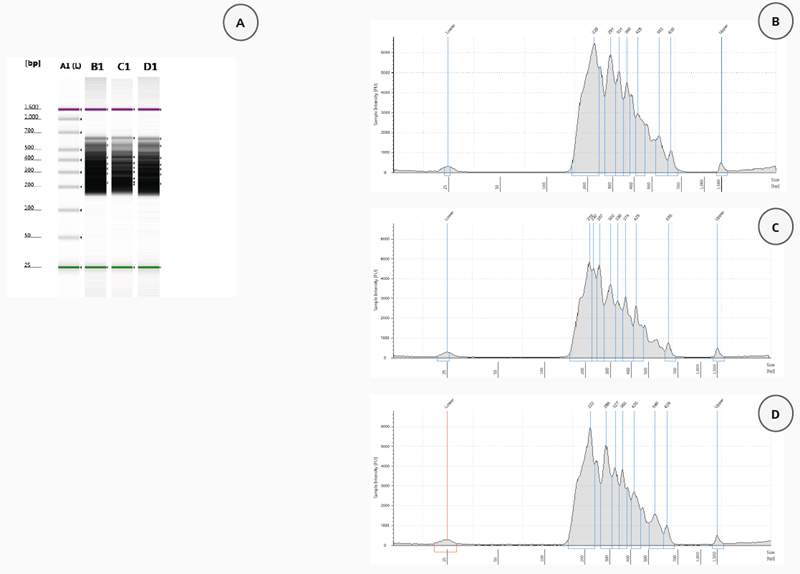 Validation of HaloPlex enrichment by 2200 TapeStation analysis. (A) Gel Image of 3 analysed samples. Lane A1: High Sensitivity Ladder, Lane B1: patient sample 115, Lane C1: patient sample 116, Lane D1: patient sample 117. Electropherograms (B-D): patient sample 115 (B), patient sample 116 (C), patient sample 117 (D)