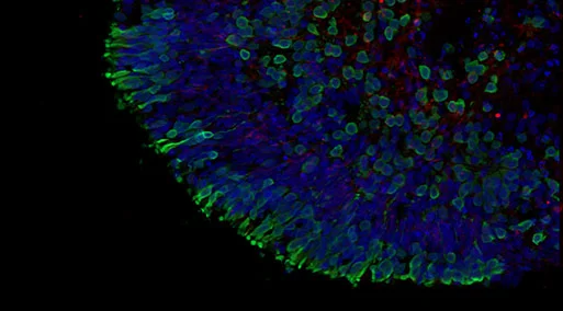 In vitro assessment of ocular toxicity and phenotypic rescue strategies