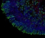 In vitro assessment of ocular toxicity and phenotypic rescue strategies