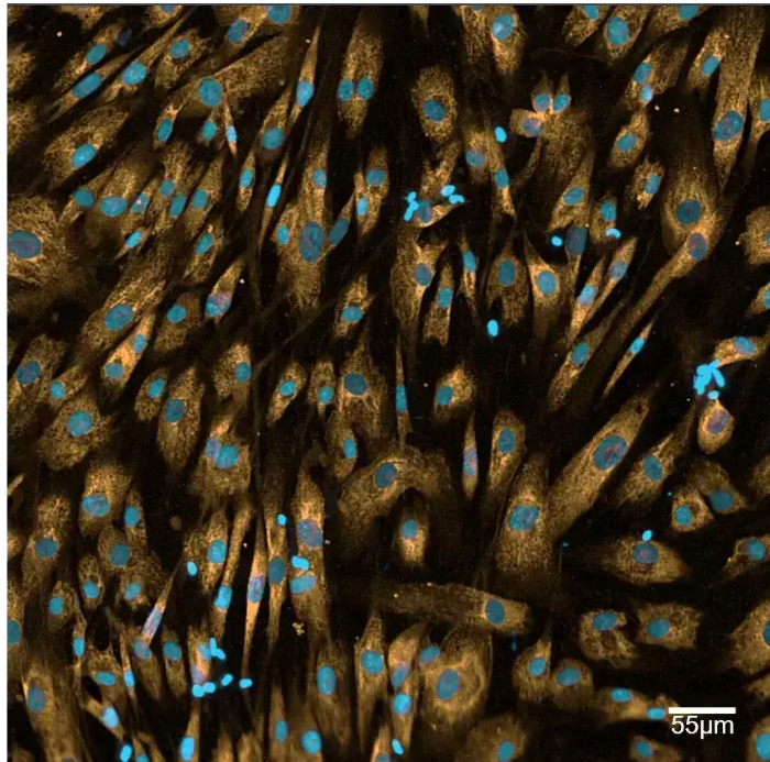 Quantitative analysis of fibroblast-to-myofibroblast transition (FMT)