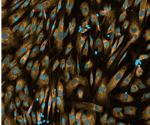 Quantitative analysis of fibroblast-to-myofibroblast transition (FMT)