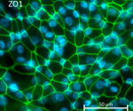 Assessment of gene therapy viral vectors in RPE cells