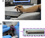 Exploring coronary flow reserve measurement