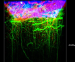 Deep brain imaging using advanced surgical techniques and two-photon microscopy