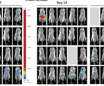 Targeted therapy induces regression in colorectal liver metastases