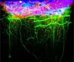 Utilizing cranial window and cannula techniques for deep brain imaging