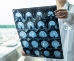 Using the Morris water maze to gain insights into neurodegenerative disease
