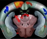 Characterizing the mouse spared nerve injury model