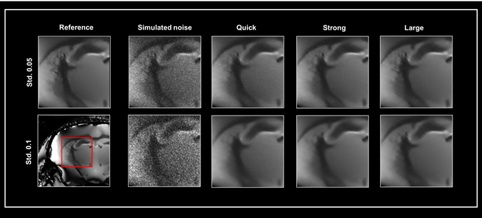 Smart Noise Reduction using different neuronal networks