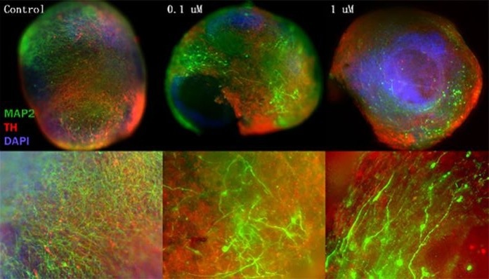 α-syn PFFs induce neuronal damage in brain organoids