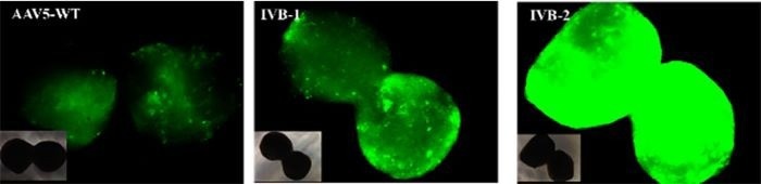 GFP fluorescence expression in brain organoids transduced with different AAV serotypes