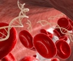 Automated cfDNA extraction for neonatal diagnostics