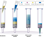 The importance of sample preparation for chromatographic analysis
