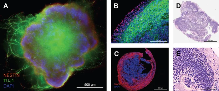 Staining of Cerebral Organoids for Characterization