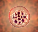 Testing acute fever with the Hi‐PCR® multiplex real-time PCR kit