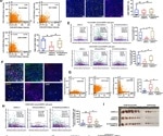 Improving the efficacy of immunotherapy in lung cancer through novel target discoveries