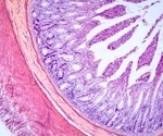 Modeling the intestinal epithelial barrier in vitro using human organoids