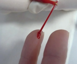 Case study: Revolutionizing forensic and clinical toxicology