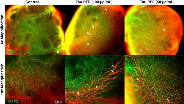Tau PFFs induce Tau aggregation in brain organoids