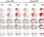 Tau protein as neurodegenerative disease research's key target