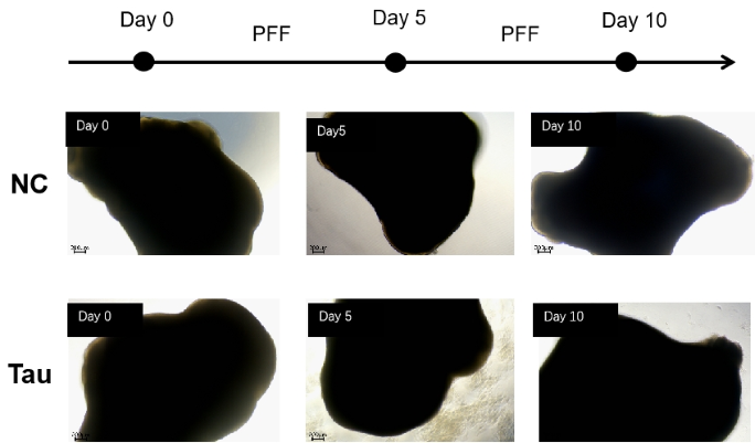 Tau PFFs-induced cell death in brain organoids