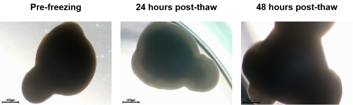 Morphological observation of brain organoids post-cryopreservation recovery