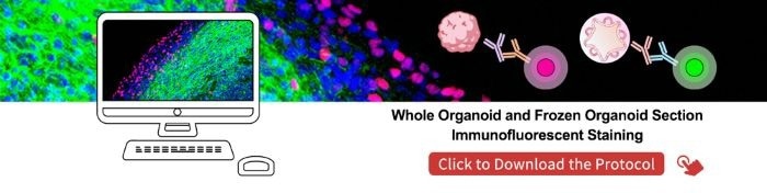 Tau proteins and brain organoids for Alzheimer