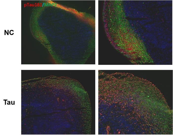 Immunofluorescence staining of p-Tau181 in brain organoids treated with Tau PFFs