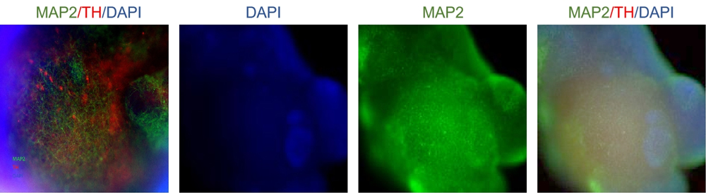 Immunofluorescence staining of brain organoids post-cryopreservation recovery