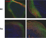 Tau proteins and brain organoids for Alzheimer's disease modeling