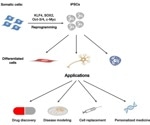 Precision treatment for Parkinson's disease