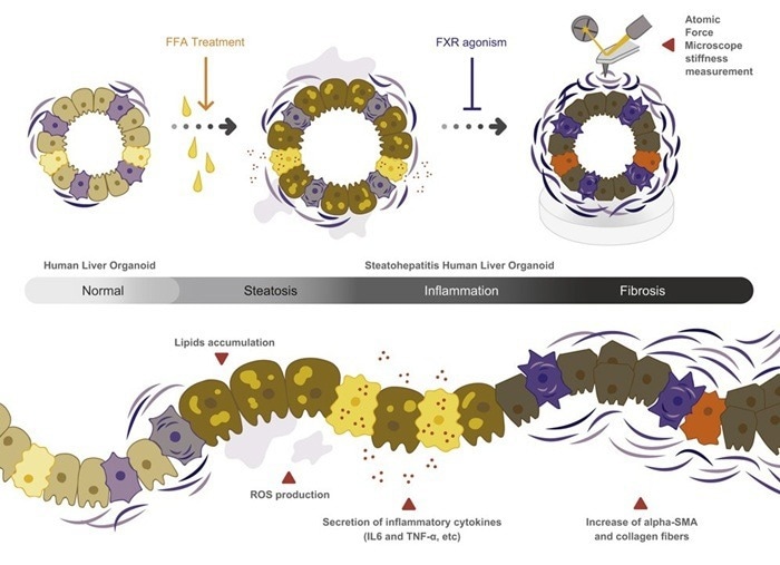 Liver organoids treated with FFA gradually exhibit key features of NASH