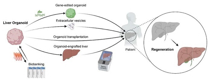 Drug toxicity screening system based on liver organoids