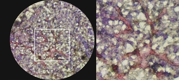Oil Red staining shows significant fatty acid accumulation in ACROBiosystems liver organoids