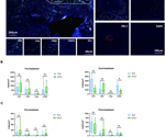 The impact of PD-1-positive immune cell ratios and TLS on gastric cancer treatment response