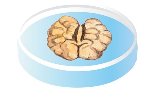 Brain Organoids.