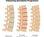 Safeguarding your spinal health