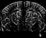 High-resolution brain mapping enabled by ultrafast doppler imaging