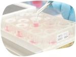 In vitro ADME services for measuring drug ADME without animal use