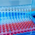 Kidney toxicity service: Investigative kidney toxicity and drug safety evaluation