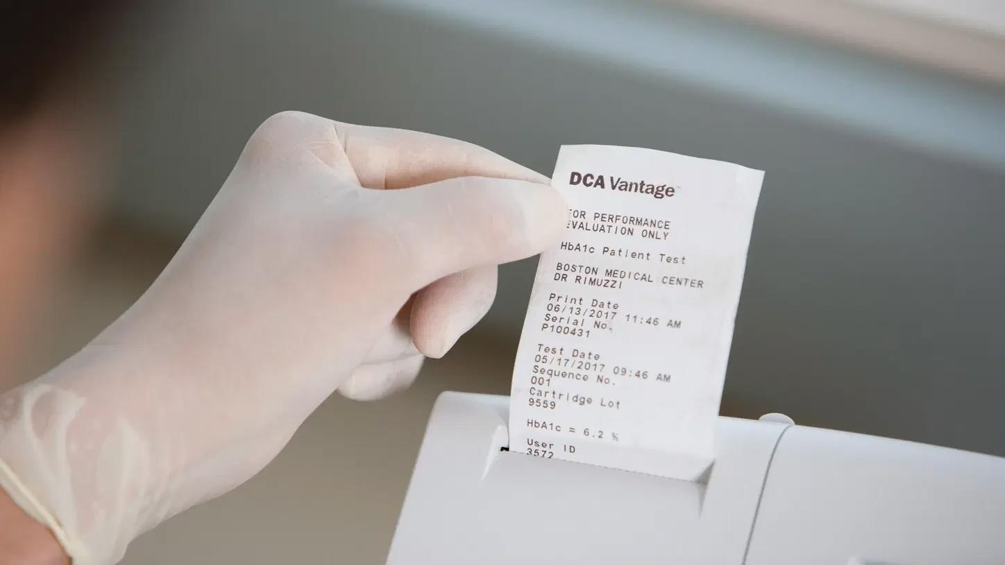 Siemens DCA Vantage Analyzer