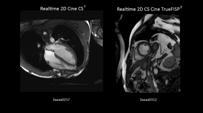 Realtime 2D Cine CS