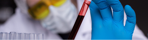 Exploratory biomarker analysis for enhanced PD studies.