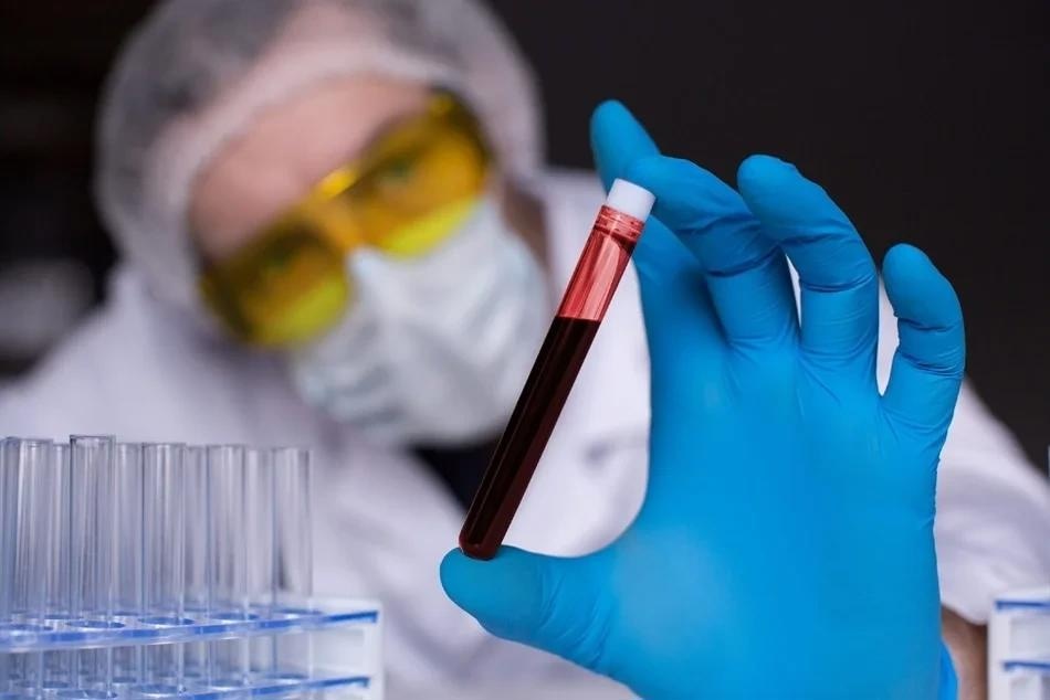 The Simoa® Accelerator Laboratory for biomarker testing and assay development