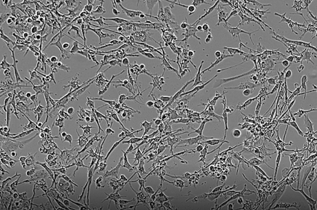 axoCells™: Functional iPSC-derived Microglia for neuroinflammatory drug discovery