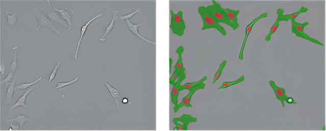 Left: CE Bright Field. Right: Cell Recognition image